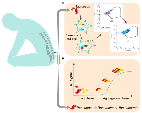 The most promising techniques for the quantitation of tau seeding activity in human biofluid